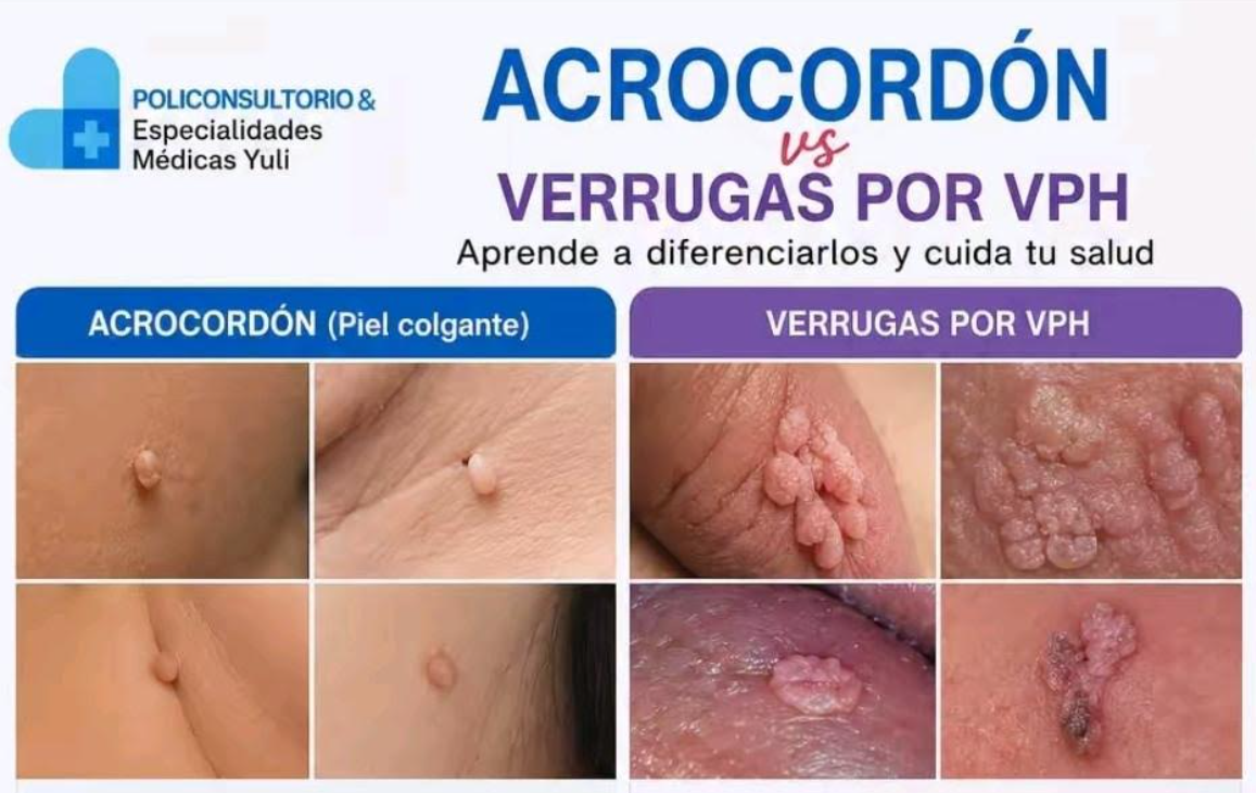 🚨 SI TIENES ESTO EN TU PIEL, NO LO IGNORES 🚨