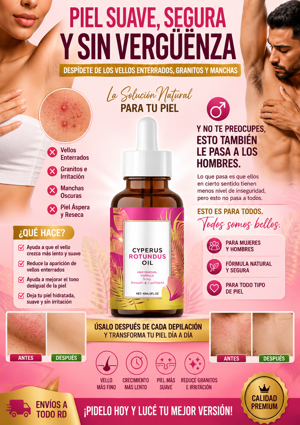 💧 CYPERUS ROTUNDUS OIL-ELIMINA EL VELLO DESDE LA RAIZ