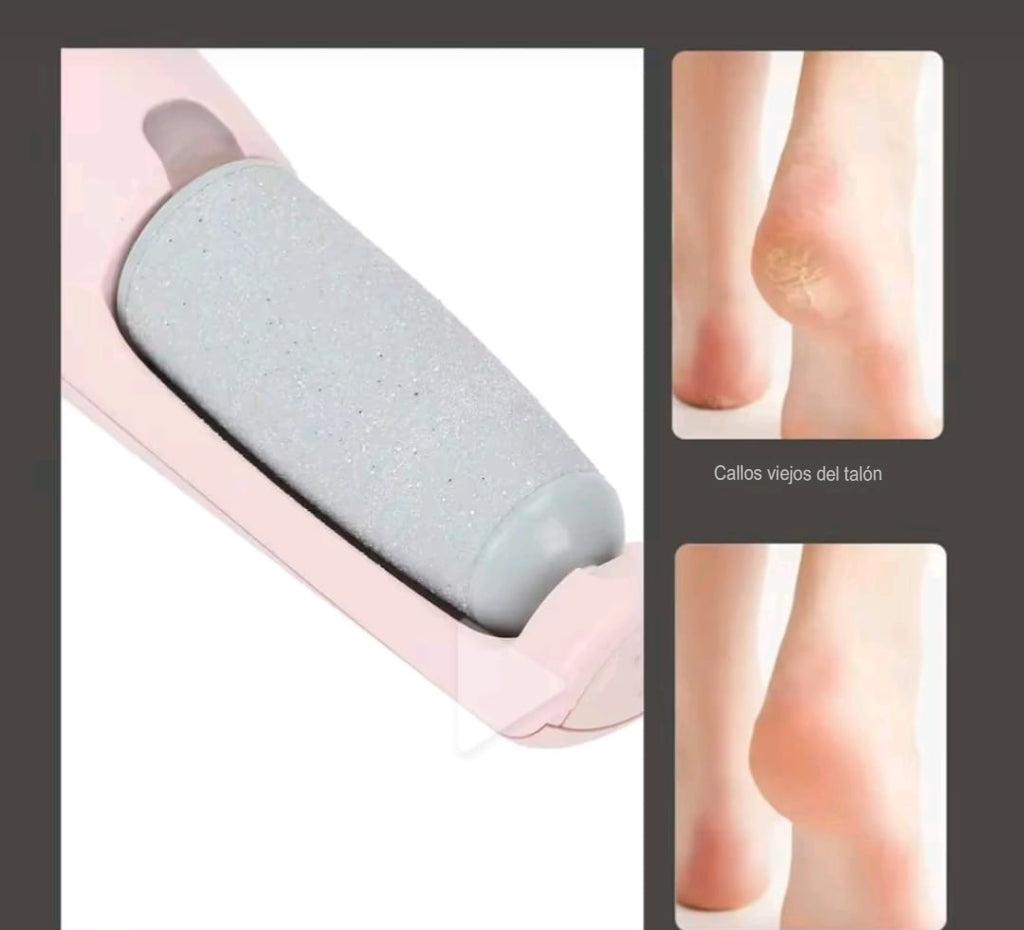 REMOVEDOR DE CALLOS ELÉCTRICOo👣 🤲