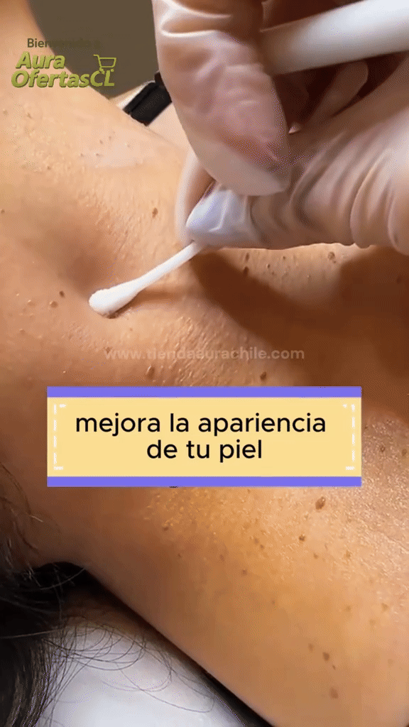 🌿 Eliminador de Verrugas