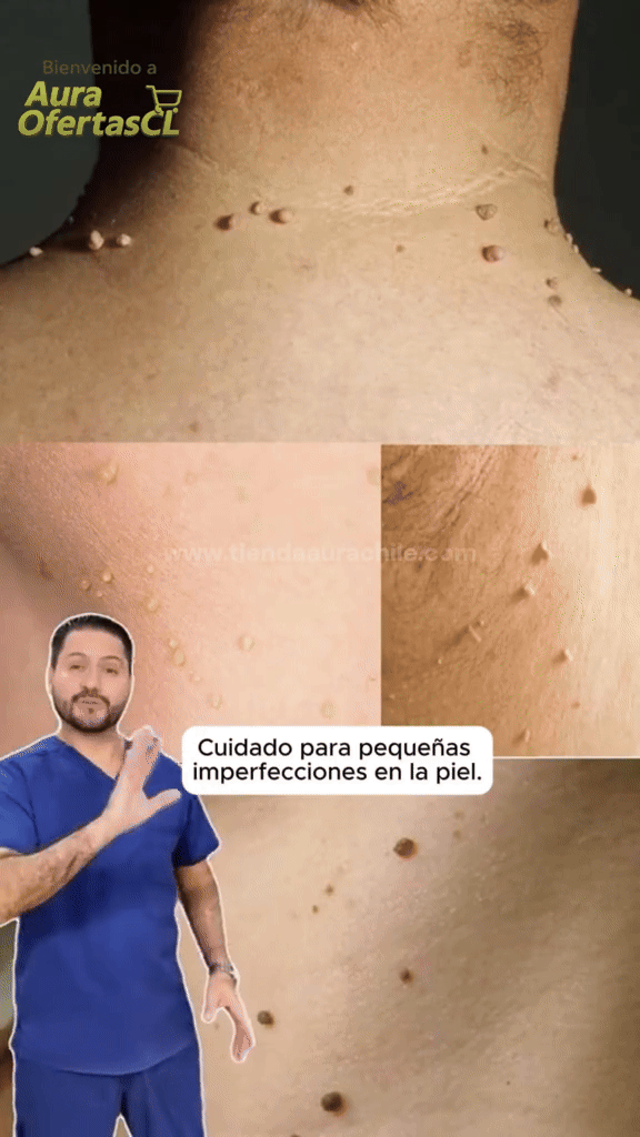 🌿 Eliminador de Verrugas