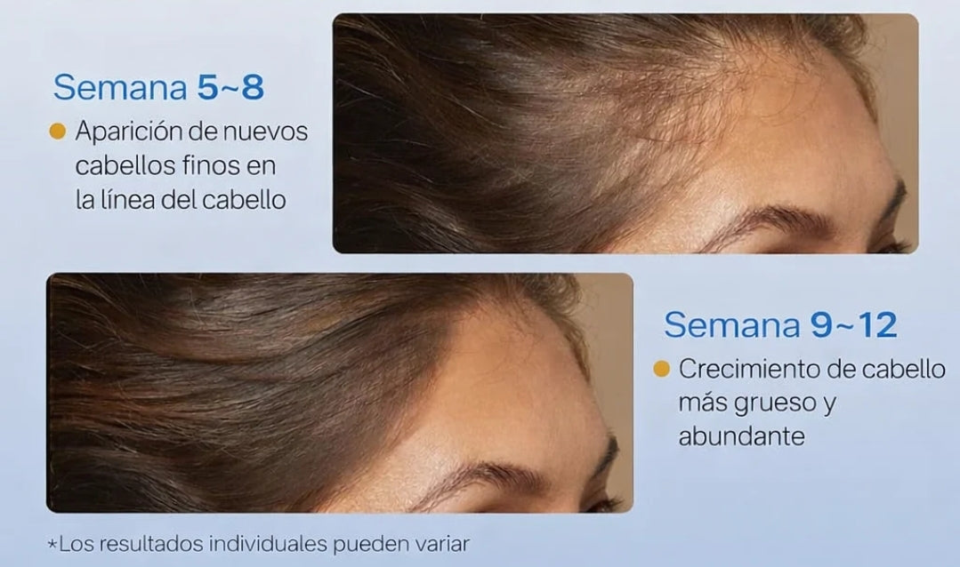 SERUM ROLL-ON OLVIDATE DE SER CALVO🧑‍🦲👴🏻