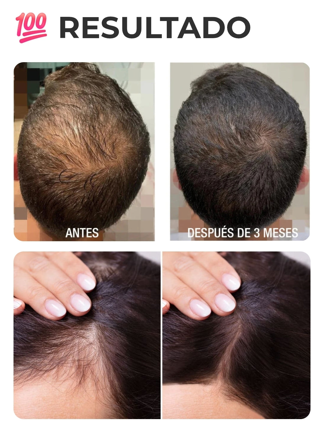 SERUM ROLL-ON OLVIDATE DE SER CALVO🧑‍🦲👴🏻