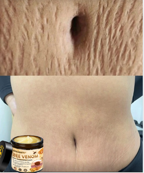 🐝 BEE VENOM CARE CREAM🐝