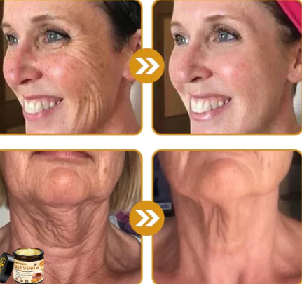 🐝 BEE VENOM CARE CREAM🐝