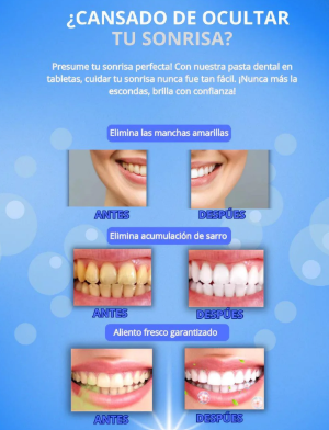 🤢¿TIENES DIENTES CON CARIES, HOYOS, MANCHAS O DESGASTADOS?😷