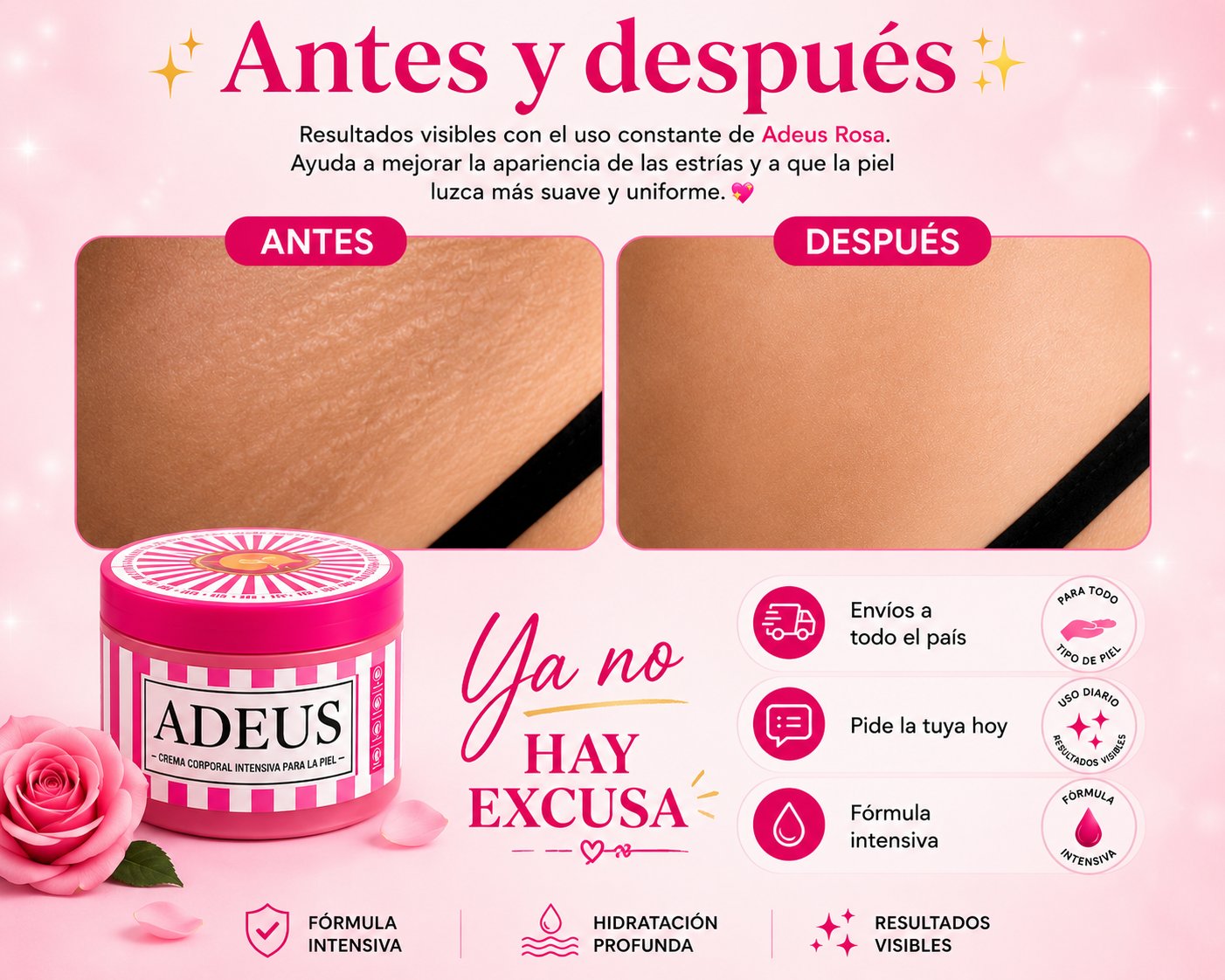 🌸 ¿TIENES ESTRÍAS? YA NO HAY EXCUSA🌸 ADEUS 💕