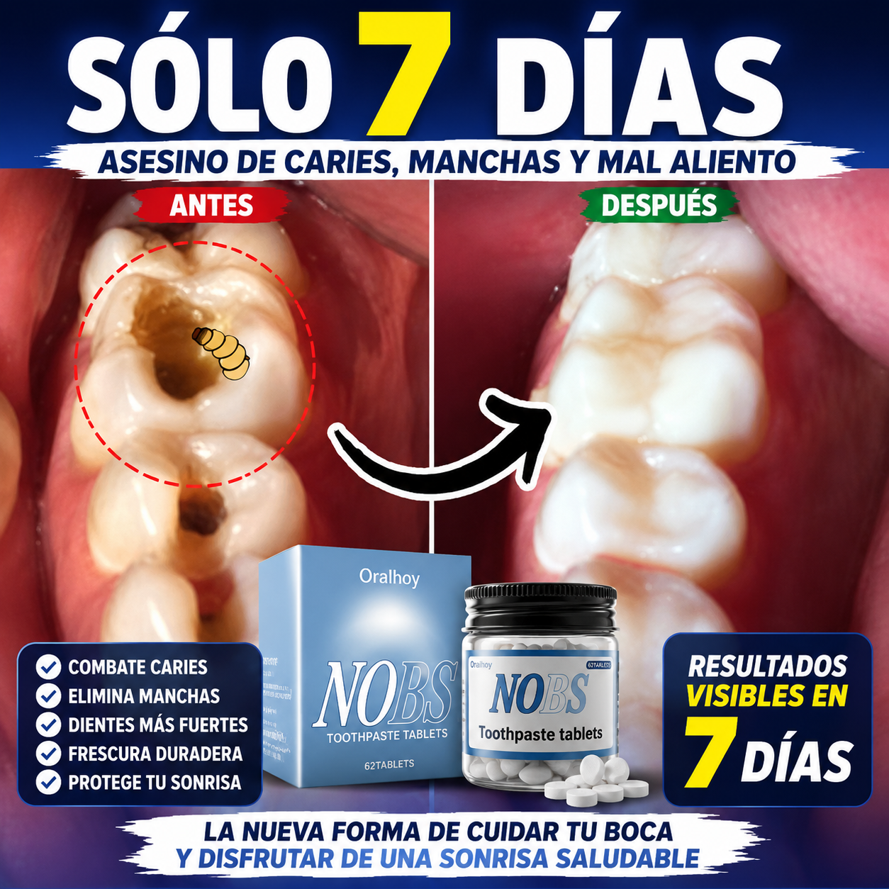 🤢¿TIENES DIENTES CON CARIES, HOYOS, MANCHAS O DESGASTADOS?😷