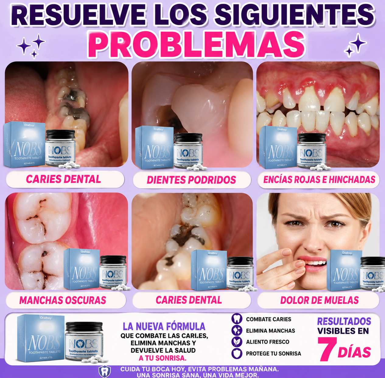 🤢¿TIENES DIENTES CON CARIES, HOYOS, MANCHAS O DESGASTADOS?😷