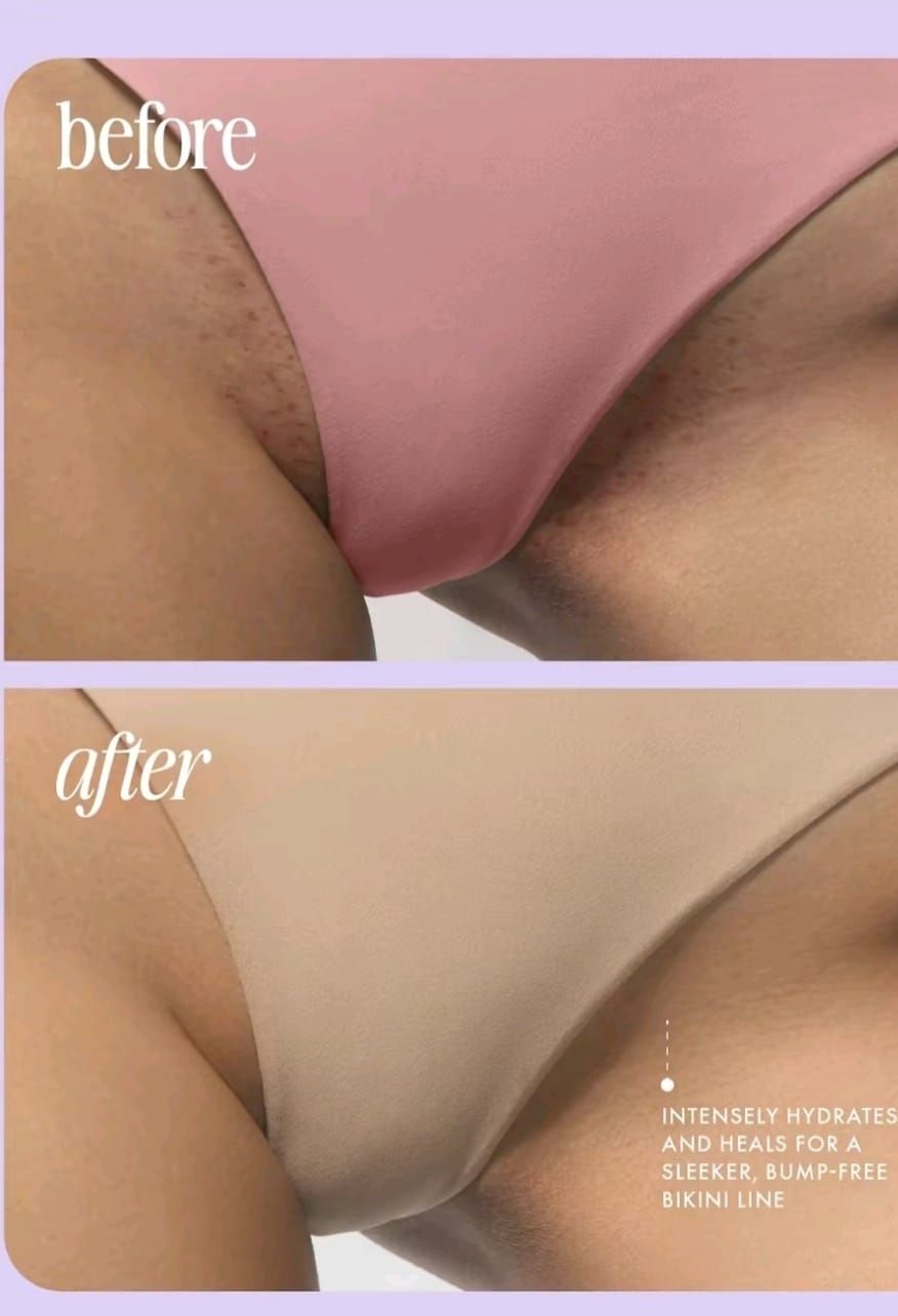 🌸TRULY 100ml: Dile adiós a manchas, vello enterrado y zonas oscuras🌸