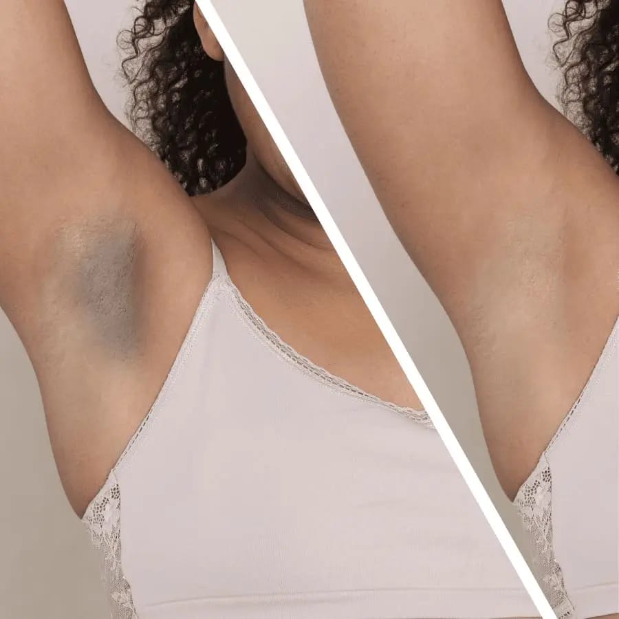 🌸TRULY 100ml: Dile adiós a manchas, vello enterrado y zonas oscuras🌸