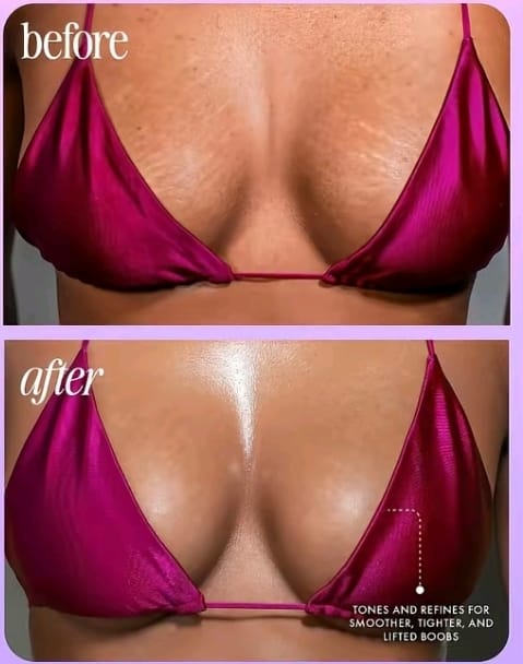 🌸TRULY 100ml: Dile adiós a manchas, vello enterrado y zonas oscuras🌸